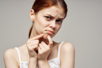 pretty woman with pimples on the face hygiene light background