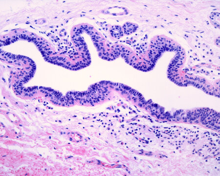 Human Breast Gland. Lactiferous Duct