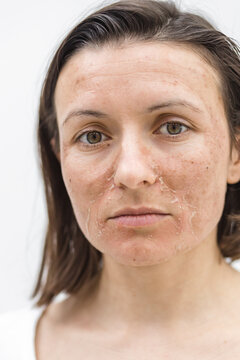 Cropped photo of woman with dry skin over white background.