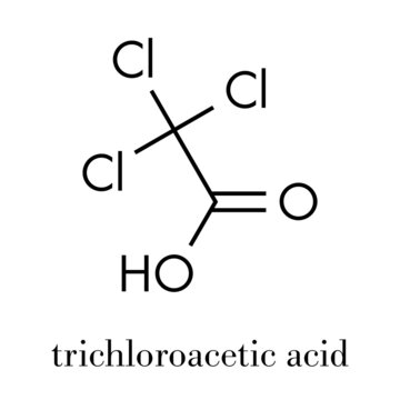 Trichloroacetic acid (TCA) molecule. Used in dermatological treatment of warts and related skin conditions. Skeletal formula.