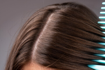 Close up problem hair. Macro hair care and hair loss concept.