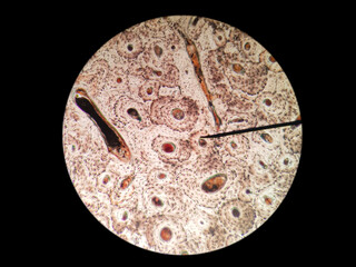Histological of compact ground bone (haversian system/osteon) cross section