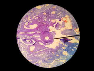 Histology of decalcified bone cross section