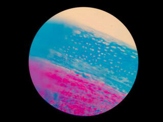 Histology of fibrocartilage cross section