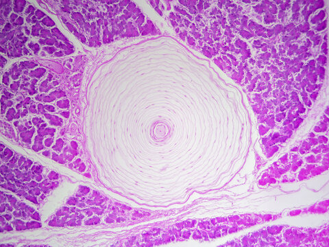 Histology microscope image of Pacinian corpuscle of the dermis in skin (100x)