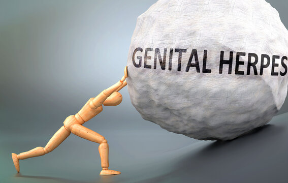 Genital herpes - depiction, impression and presentation of this condition shown a wooden model pushing heavy weight to symbolize struggle and pain when dealing with Genital herpes, 3d illustration