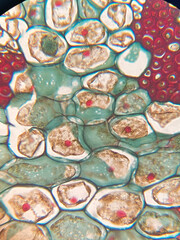 microscopic photo of viscum stem structure