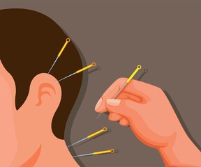 Chinese traditional acupuncture cartoon illustration vector