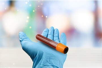 Hand holding blood sample tube. Blood sample for coagulation test in the hematology laboratory