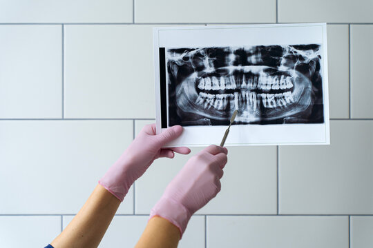 Doctor showing teeth X ray