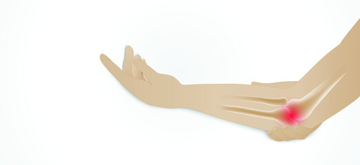 Illustration of Rheumatiod arthritis, Joint pain. Elbow pain.