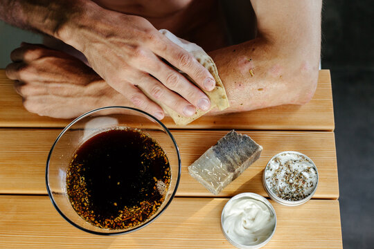 Man with skin disease applying herbal decoction on hand