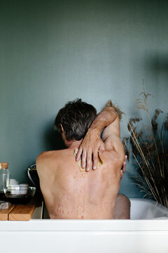 Man with psoriasis applying herbal decoction with cloth