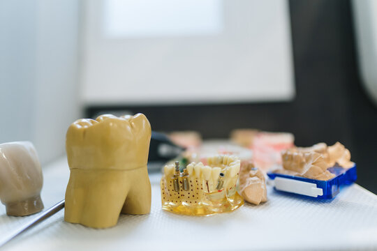 Teeth model on shelve