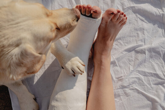 Dog Paw On Broken Leg In Cast 