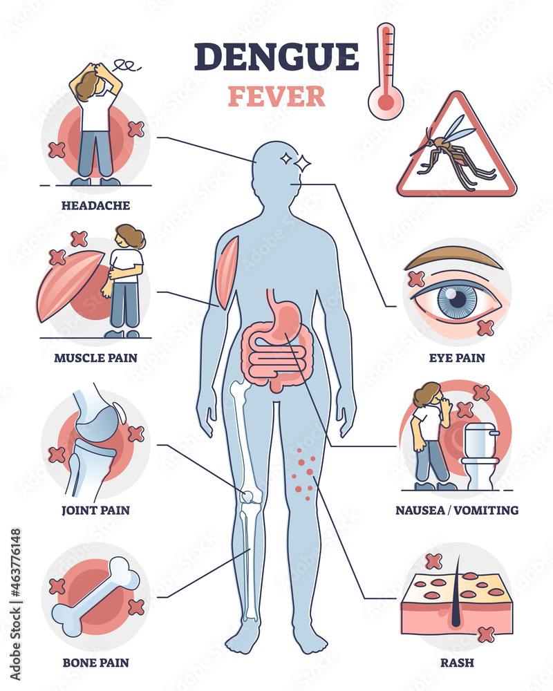 Wall mural Dengue fever symptoms awareness poster, educational vector illustration diagram. Infectious mosquito disease diagnosis - skin rash, vomiting or nausea, headache, and pain of the various body parts.