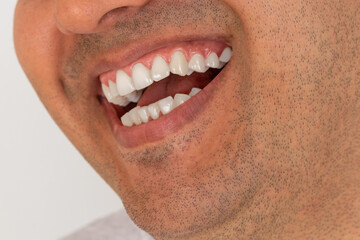 Close up photo of brown skinned young adult man with gum smiling. White teeth concept.