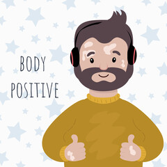 Bearded Man wearing Headphones with Vitiligo. Body Positive and Self Love. Vector illustration Cartoon style