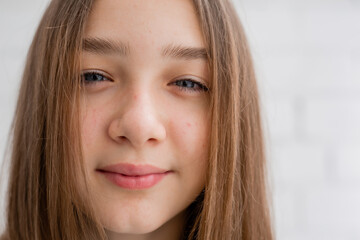 Face of a teenage girl in close up. Teen with problematic skin. Girl with a square hairstyle. Acne and scars. Natural portrait. No makeup and retouch. High quality photo