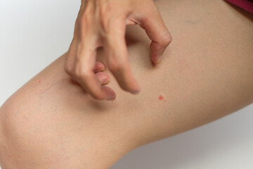 Close up of woman scratching the itch on her leg on isolated whtie background. Dry skin, dermatitis, irritation, animal, food, allergy, insect bites concept.