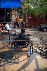 disabled person with leg deformity on wheel chair