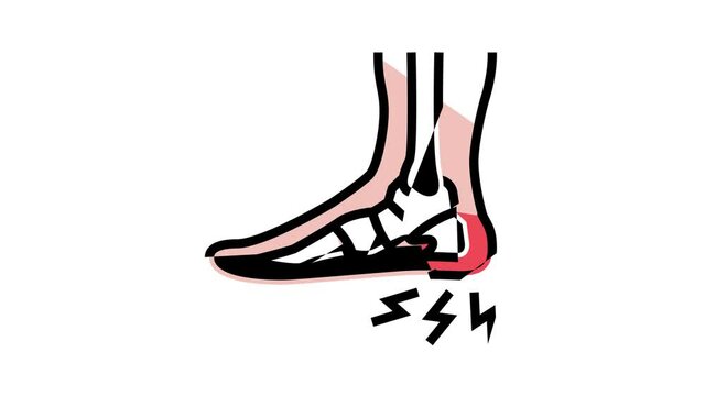 heel spur disease animated color icon. heel spur disease sign. isolated on white background
