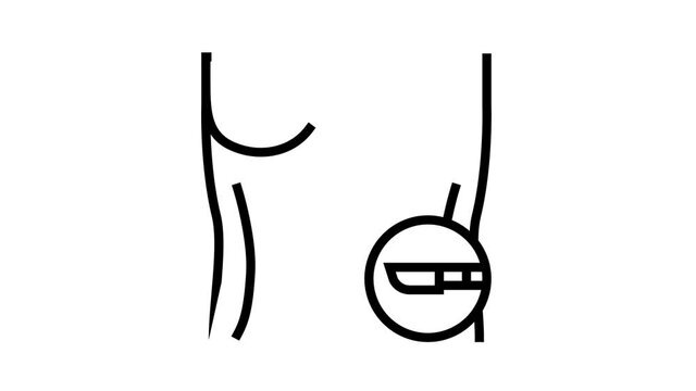 breast gynecomastia disease animated line icon. breast gynecomastia disease sign. isolated on white background