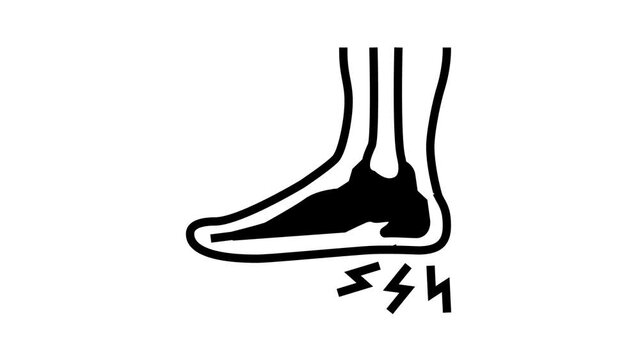 heel spur disease animated line icon. heel spur disease sign. isolated on white background