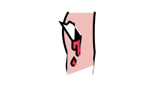 open limb fracture disease animated color icon. open limb fracture disease sign. isolated on white background