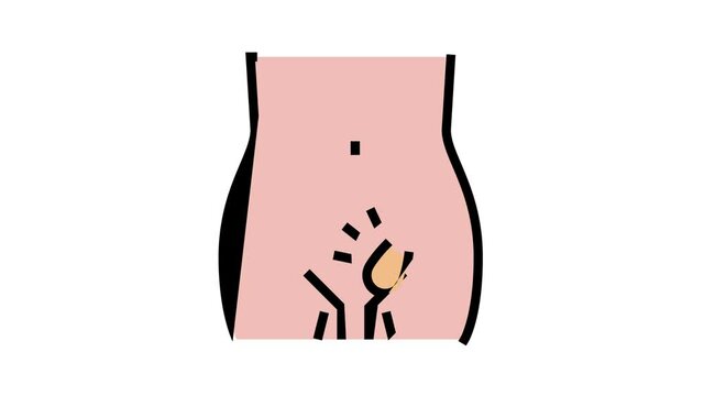 hernia inguinal disease animated color icon. hernia inguinal disease sign. isolated on white background