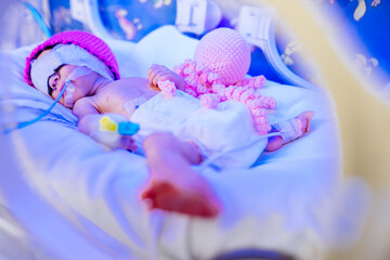 New born premature baby girl in intensive care unit in a medical incubator under ultraviolet lamp. Phototherapy treatment to reduce bilirubin levels in newborn jaundice. Neonatal icu. - obrazy, fototapety, plakaty