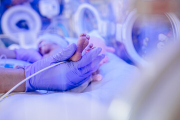 Macro photo of doctor's hands and legs of a child. Newborn is placed in the incubator. Neonatal intensive care unit - obrazy, fototapety, plakaty