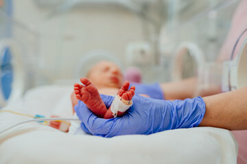 Macro photo of doctor's hands and legs of a child. Newborn is placed in the incubator. Neonatal intensive care unit