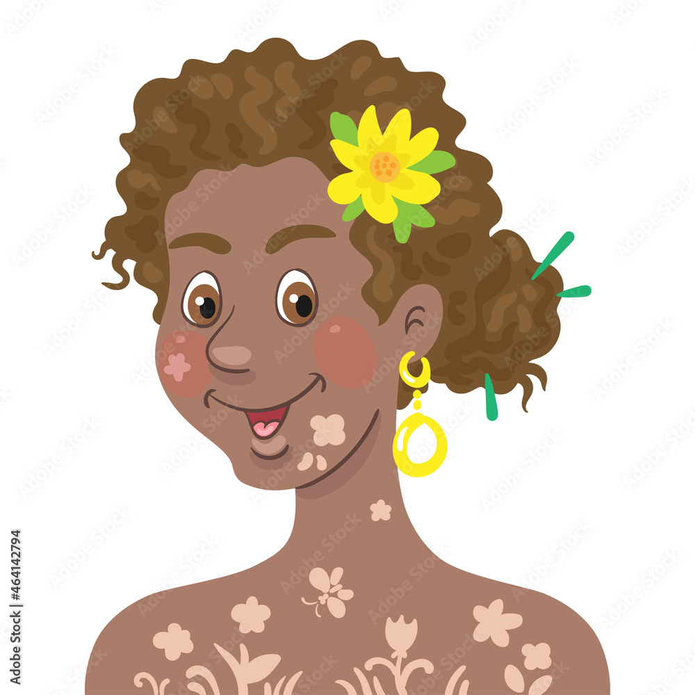 Canvas Prints Portrait of a beautiful young happy African American girl with vitiligo. In cartoon style. Isolated on white background. Vector flat illustration