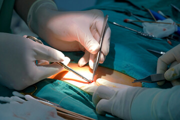 A team of doctors working together in the operating room