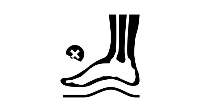 bone postural deformity feet animated glyph icon. bone postural deformity feet sign. isolated on white background