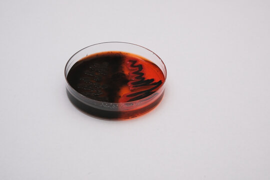 photo of growth of black bacterial colonies on macconkey agar
