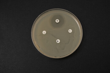 photo of growth of bacterial colonies around antibiotic discs
