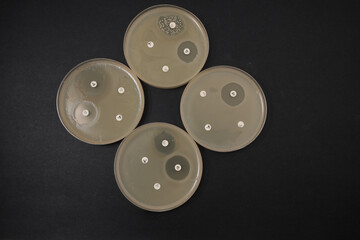 photo of growth of bacterial colonies around antibiotic discs