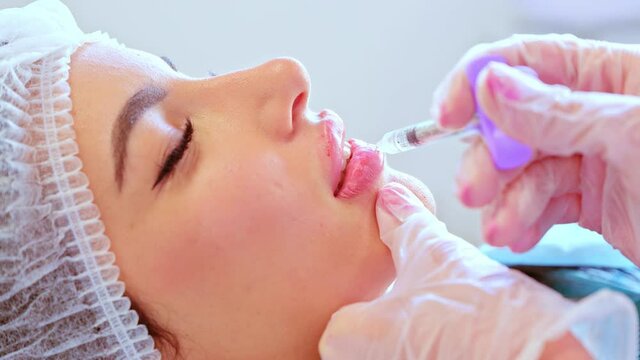 Lip augmentation procedure. Beauty injections