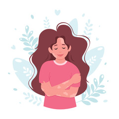 Woman with vitiligo. World vitiligo day. Self care, self love, body positive. Vector illustration