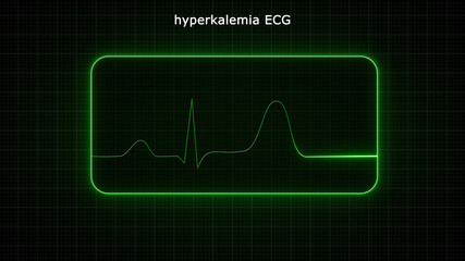 Hyperkalemia is the medical term that describes a potassium level in your blood that's higher than normal