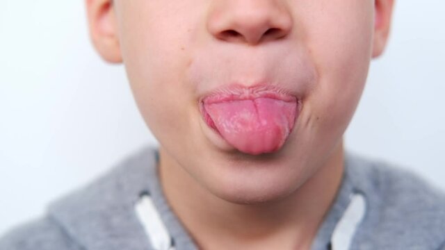 close-up of lower part of face, boy, child 8 years old opened his mouth, stuck out tongue, desquamative glossitis, performs articulation exercises for tongue, vocals, dental concept, speech therapy