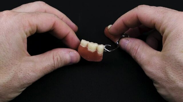 4K Partial denture upper side on black background