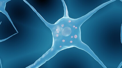 Lewy bodies in a neuron, Accumulations of proteins that develop inside nerve cells in parkinson's disease or dementia.