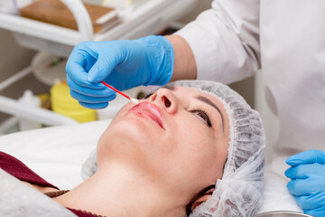 Lip augmentation. Beautician injects hyaluronic acid into the lips of a girl with a syringe. The...