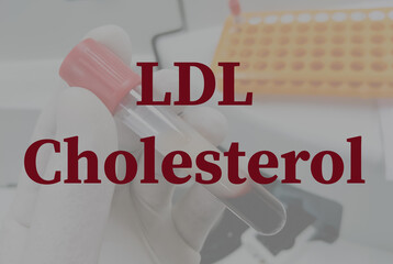 LDL cholesterol test with laboratory background, Low density lipoprotein