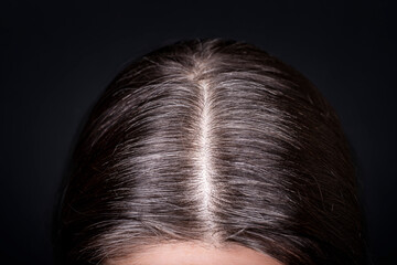 Womens head with gray hair, close-up view of regrown roots, top view on dark background.