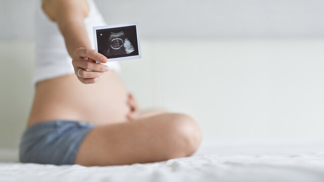 Asian pregnant Woman sitting showing ultrasound scan picture.