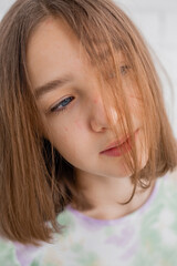 Face of a teenage girl in close up. Teen with problematic skin. Girl with a square hairstyle. Acne and scars. Natural portrait. No makeup and retouch. High quality photo